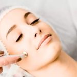 benefits of microdermabrasion